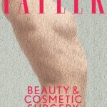 surgery-guide-cover-320×420