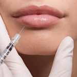 lip-fillers-sibthorpe