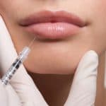 lip-fillers-sibthorpe
