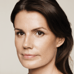 Restylane-Female-Pia-2