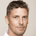 Restylane-Male-Jimmy