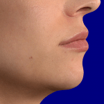 after-2-dr-sibthorpe