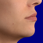 before-2-dr-sibthorpe